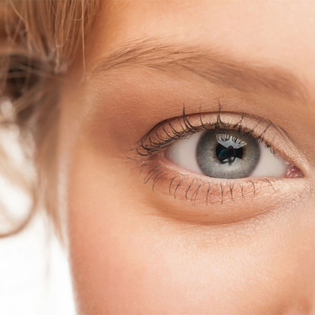 علت پف زیر چشم و روش مؤثر برای درمان آن